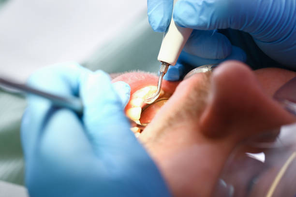 Best Urgent Dental Care in Choctaw, OK
